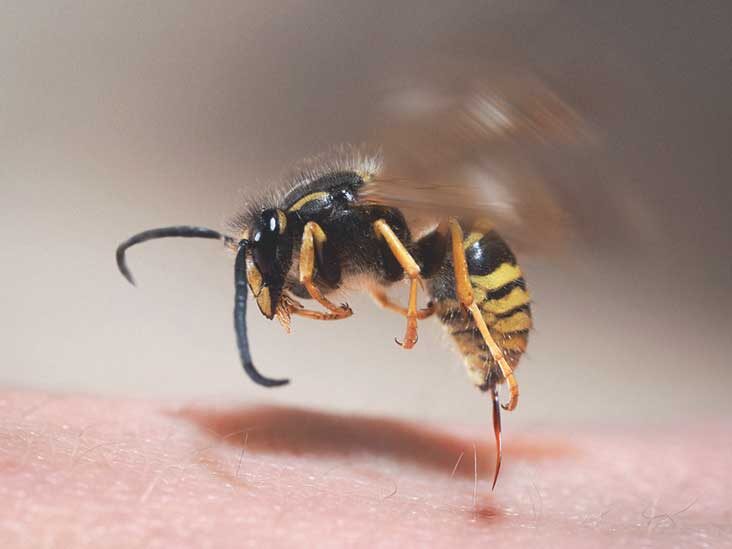 Що робити коли укусила бджола?